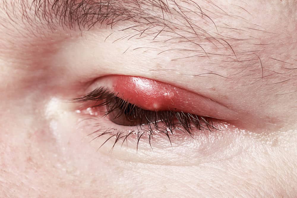 6 Eye Symptoms You Should Not Ignore