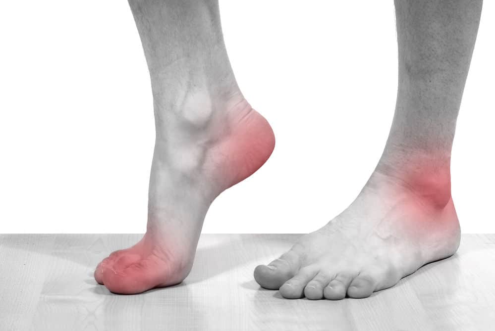 Redness on feet