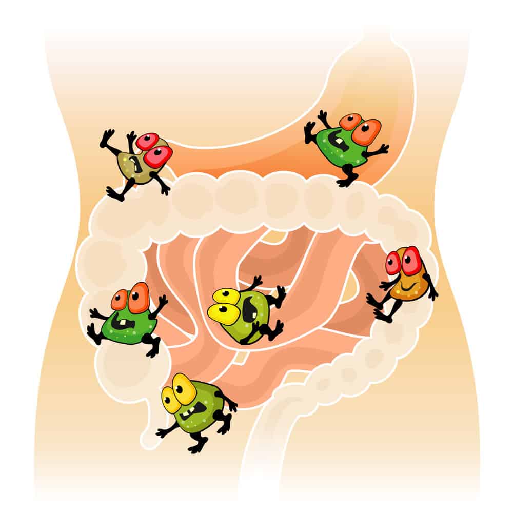 What Is Leaky Gut?