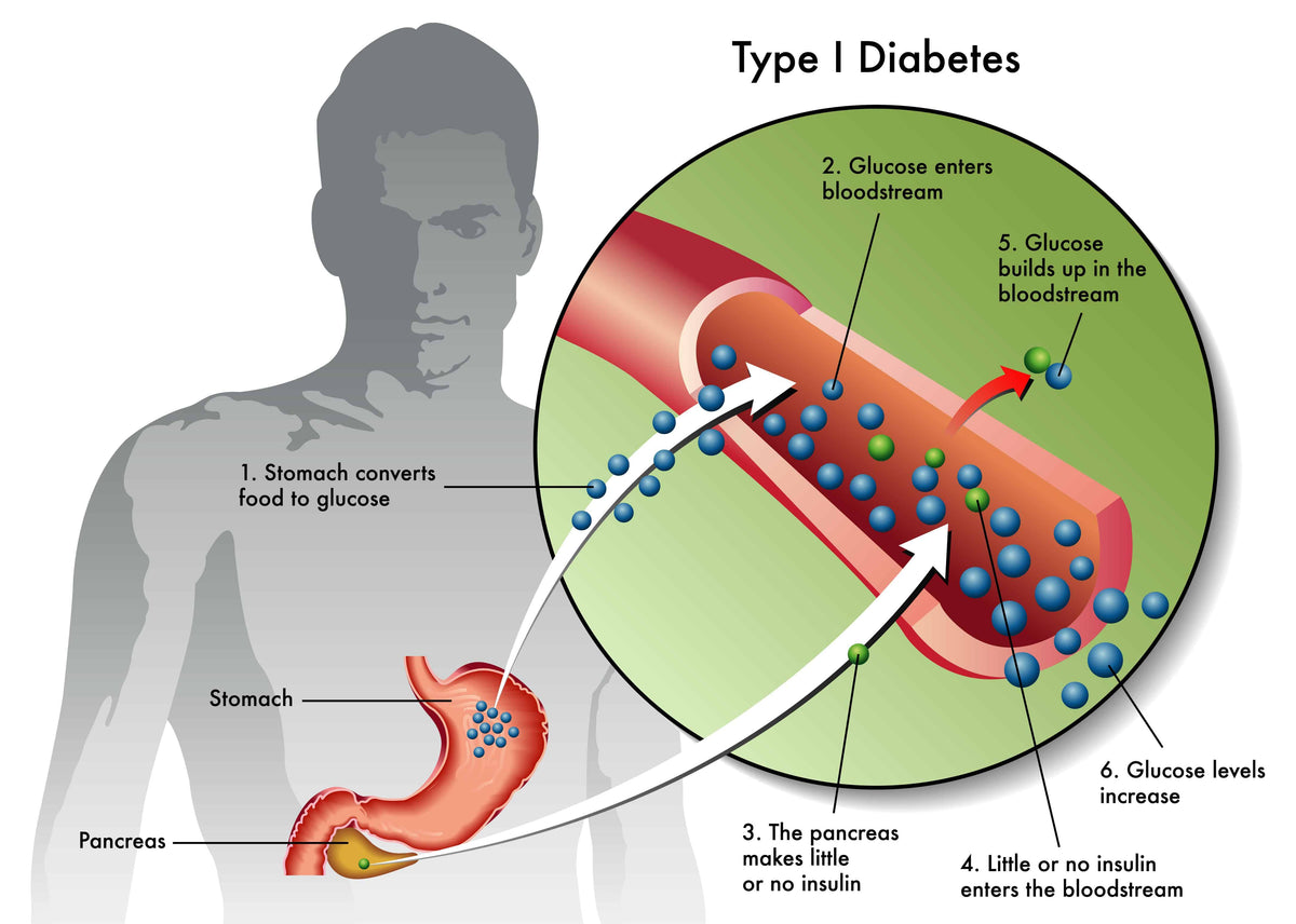 Breaking News: Diabetes Vaccine on the Horizon